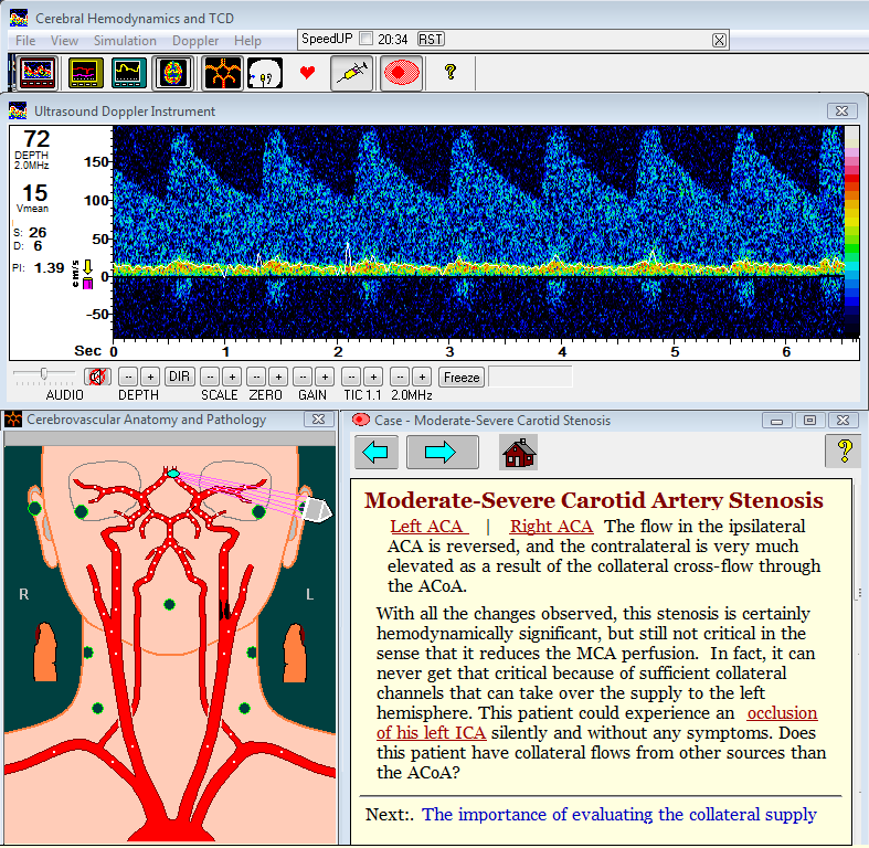 hemodynamic